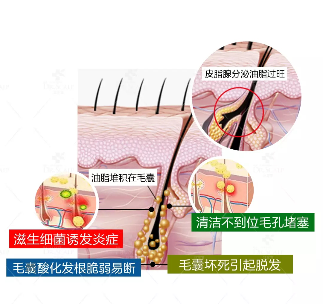重塑头皮健康，最好的方式就是从头皮养护开始。
