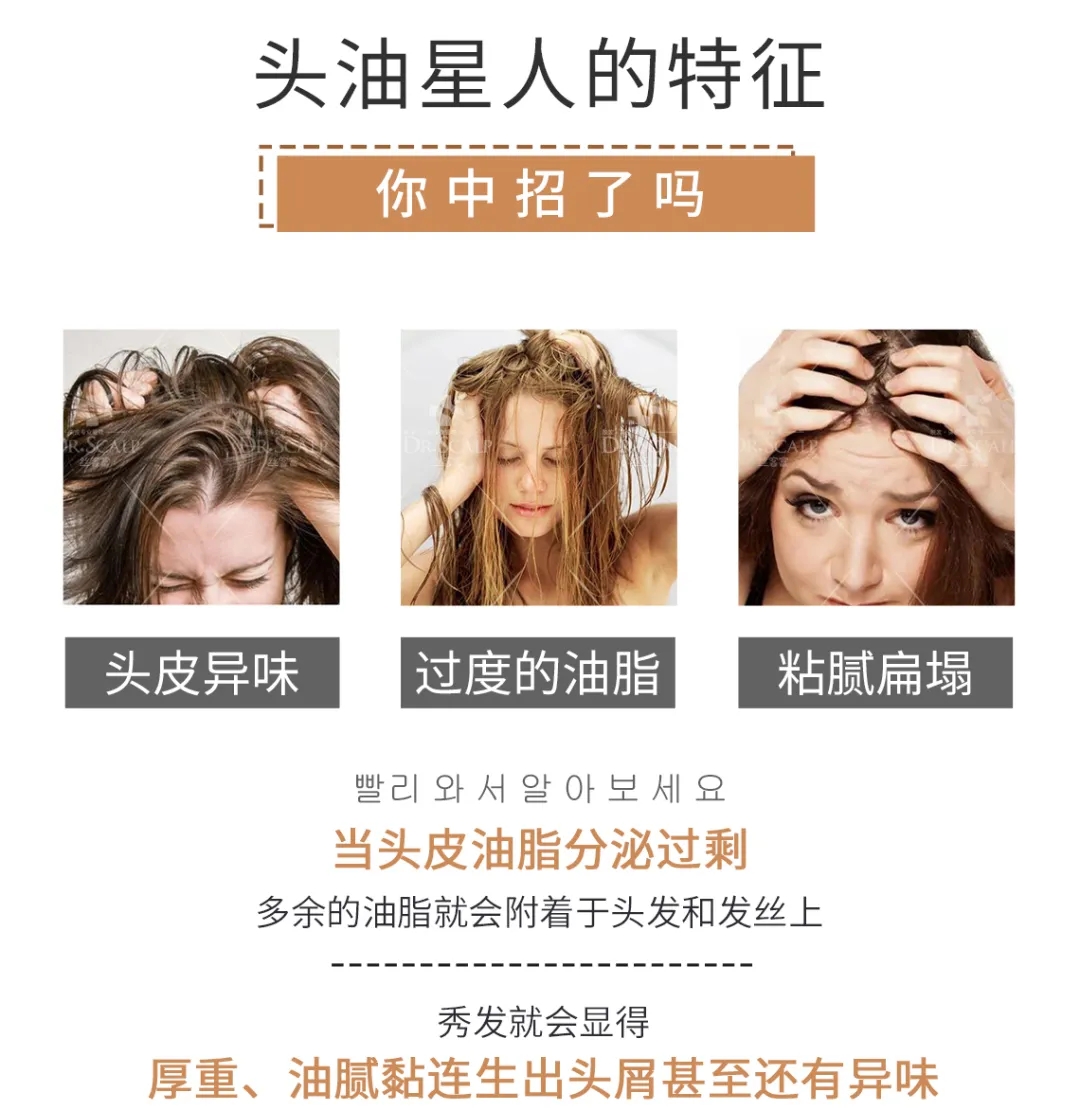 头发头皮油腻脱发 头发头皮油腻脱发